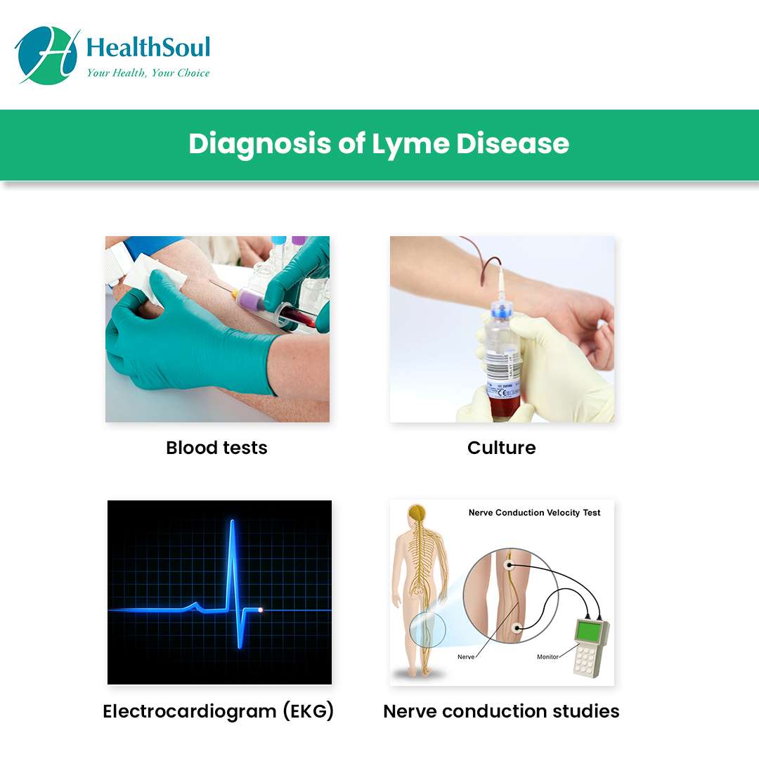 Lyme Disease: Symptoms and Prevention