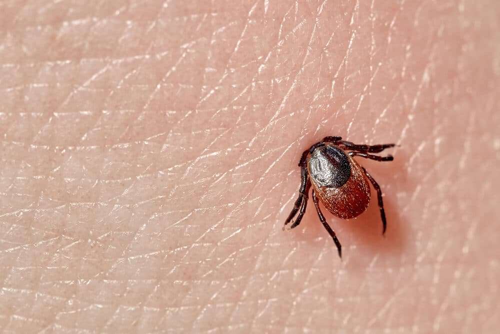 Lyme Disease Symptoms You Cant Miss