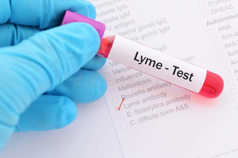 Lyme disease test stock image. Image of infection, immunology