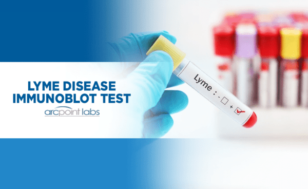 Lyme Disease Total Antibodies Blood Test 100% accuracy