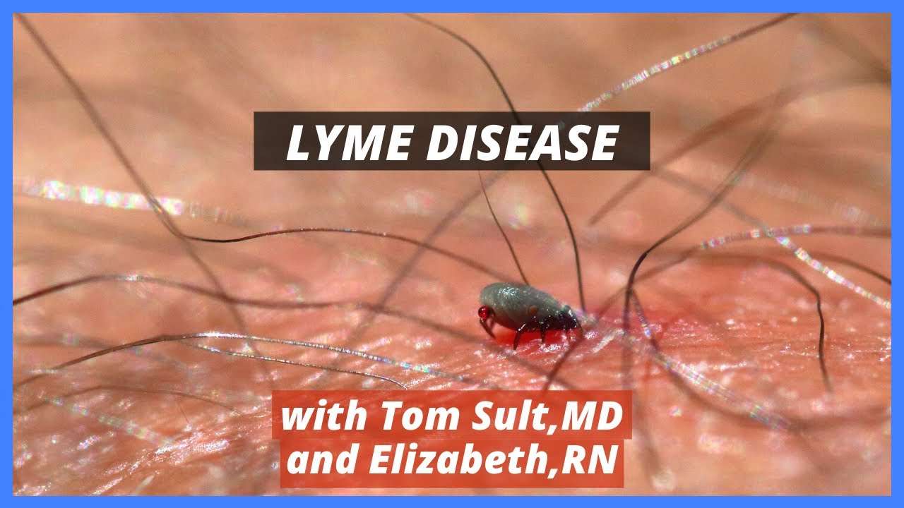Lyme Disease Treatment