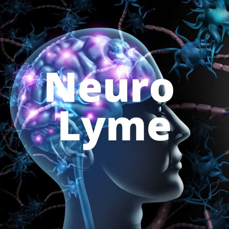 LYME SCI: Can treating mast cells help neurological Lyme disease ...
