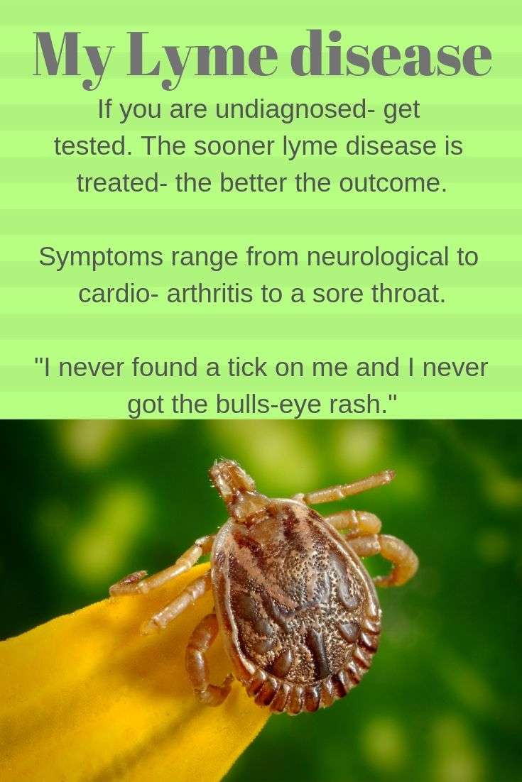 My Lyme Disease and why you should get tested!