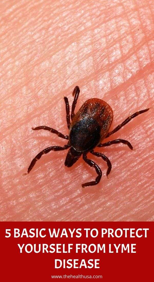 5 Basic Ways to Protect Yourself from Lyme Disease