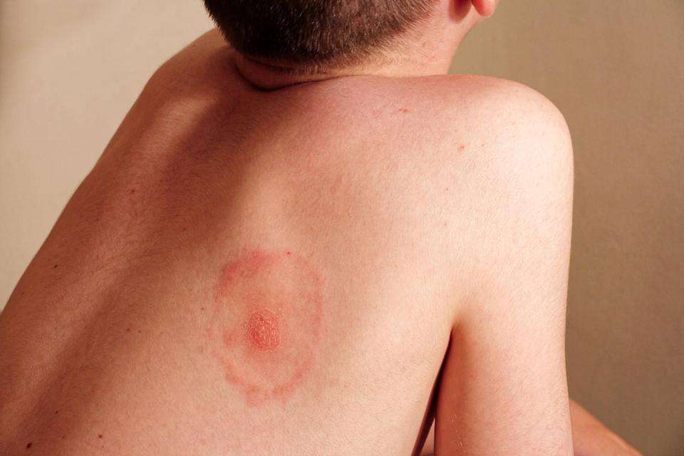 7 signs your mystery rash is something serious