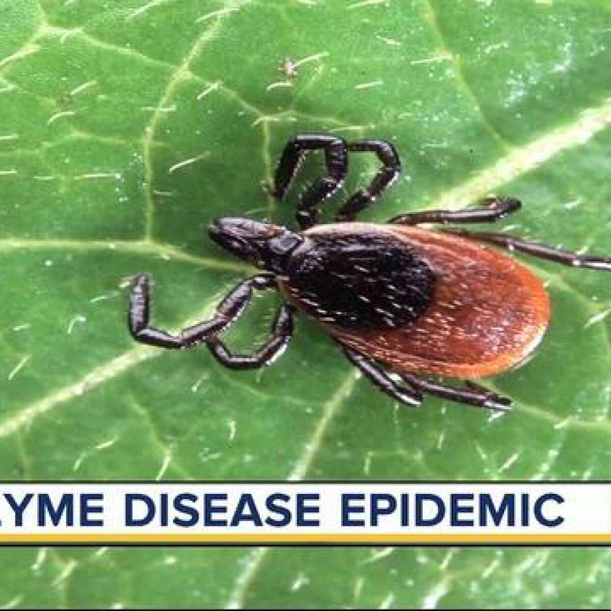 Doctors predict Lyme disease epidemic this year