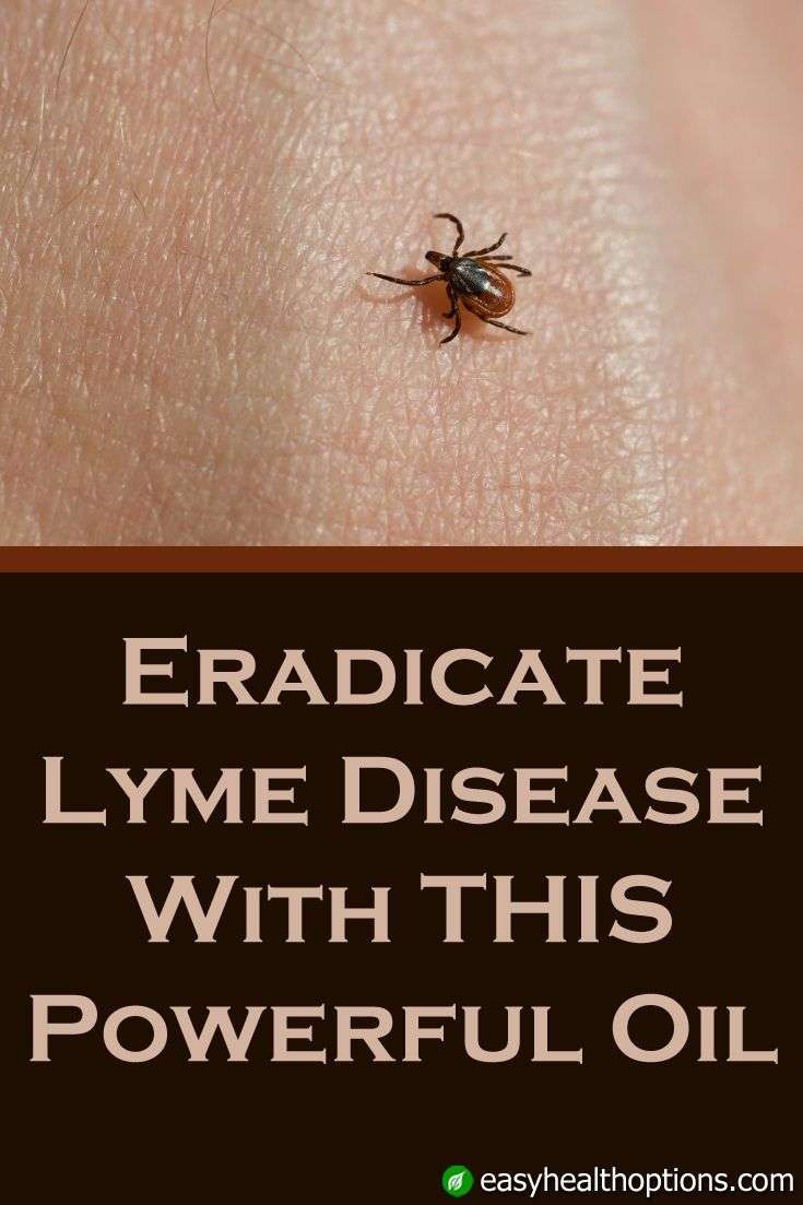 Easy Health Options® :: Eradicate Lyme disease with all