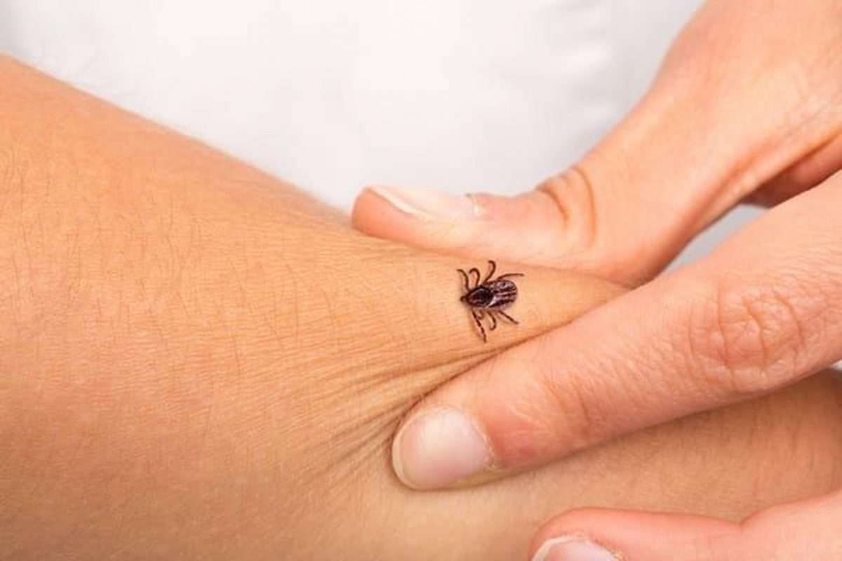 How to avoid contracting Lyme disease from tick bites this summer ...
