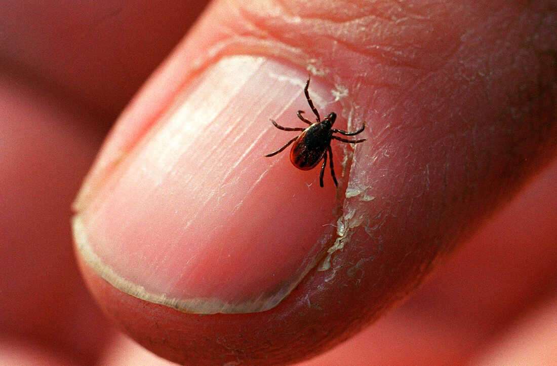 How To Avoid Ticks  And What To Do If You Get Bitten : Shots