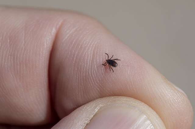 Lyme Disease: A Tick