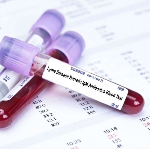 Lyme Disease Borrelia IgM Antibodies Blood Test