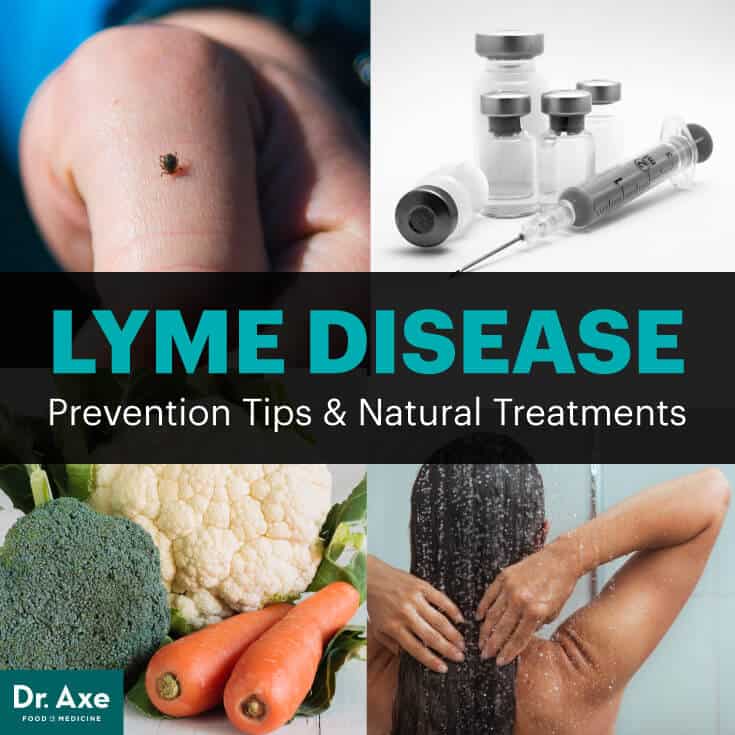 Lyme Disease Natural Treatments, Causes, How to Prevent