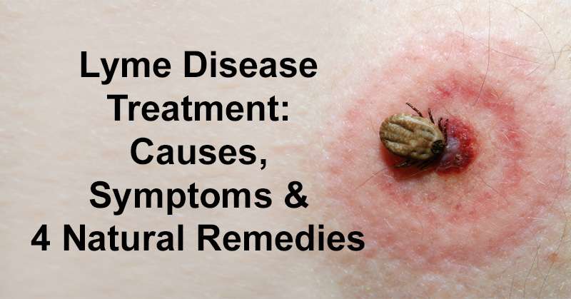 Lyme Disease Treatment: Causes, Symptoms &  4 Natural Remedies