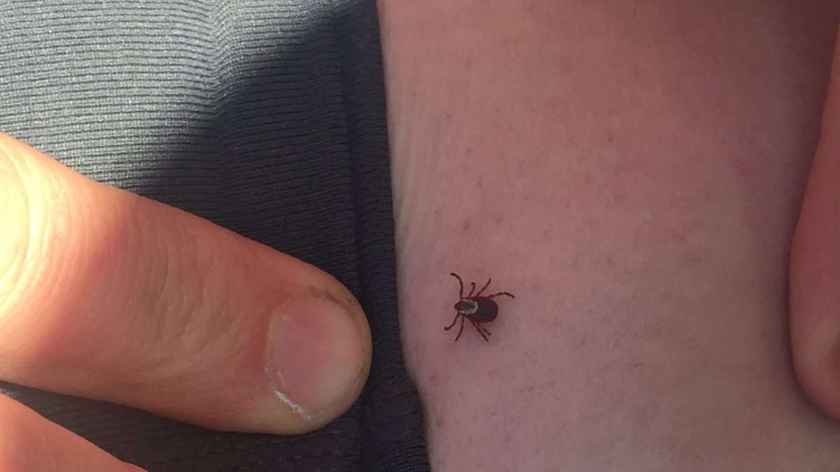 More than a bulls eye rash, Lyme Disease can be overlooked