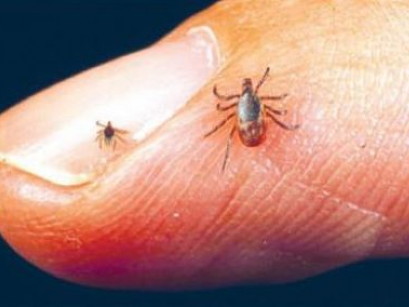 Tick Bites Can Kill You, Health Officials Say
