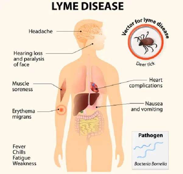 Health: Why We Should Be On The Lookout For Lyme Disease