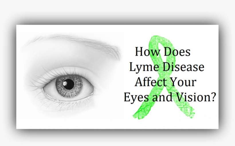 Lyme Disease Eyes