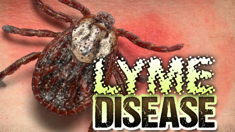 Lyme disease now in all 50 states