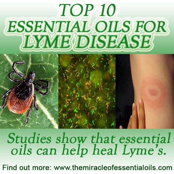 10 Essential Oils for Lyme Disease &  Recipes to Use