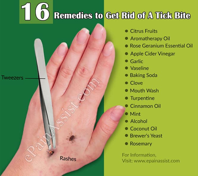 How Does A Tick Bite Look Like &  Remedies to Get Rid of it