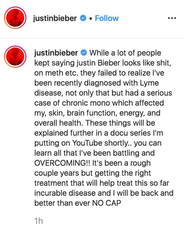 Justin Bieber confirms he has been battling lyme disease and