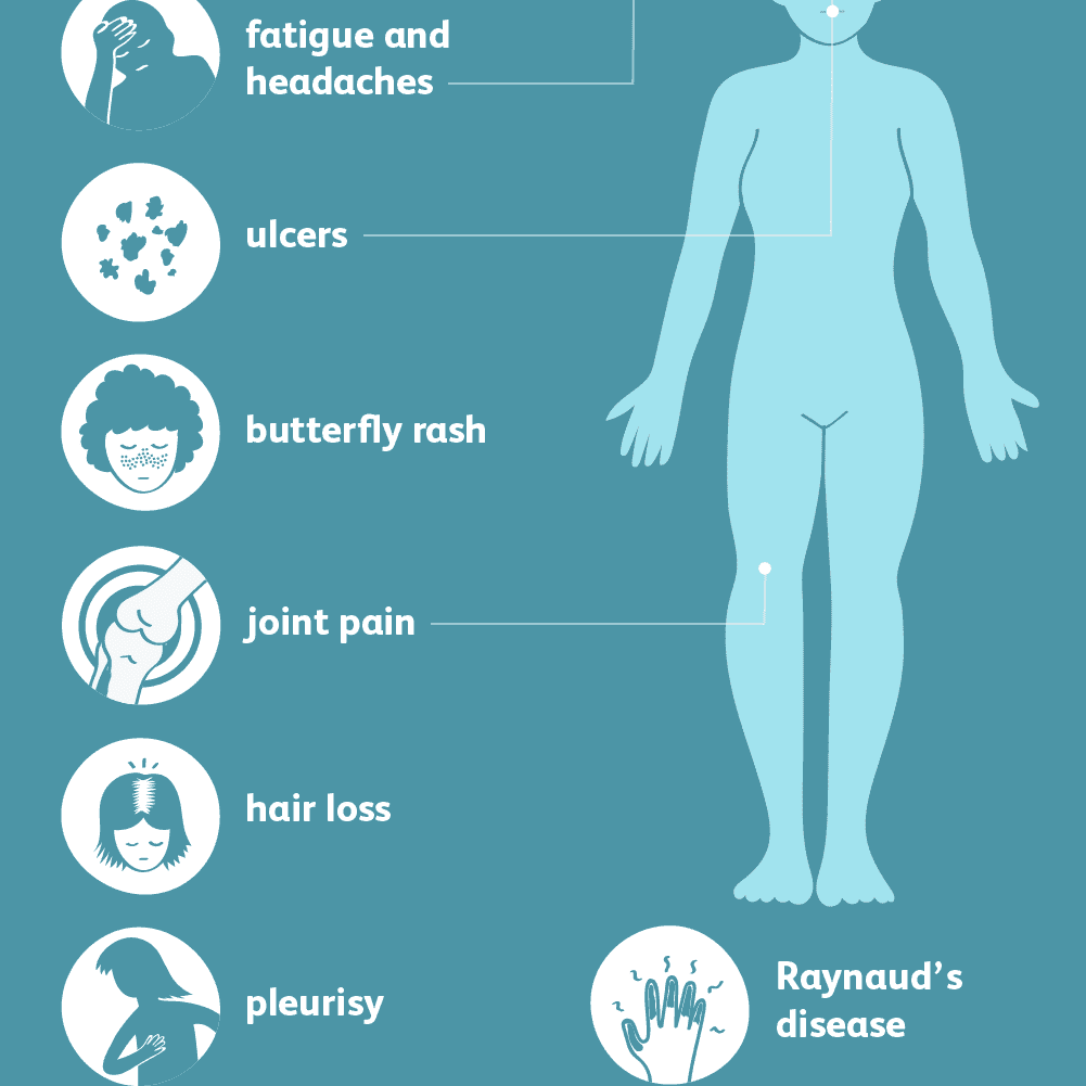 Lupus: Signs, Symptoms, and Complications