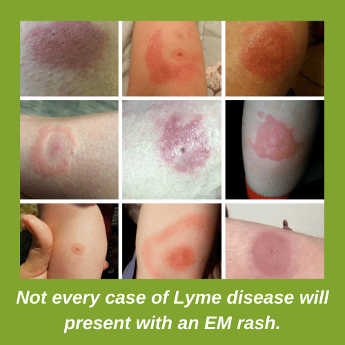 Lyme Disease UK