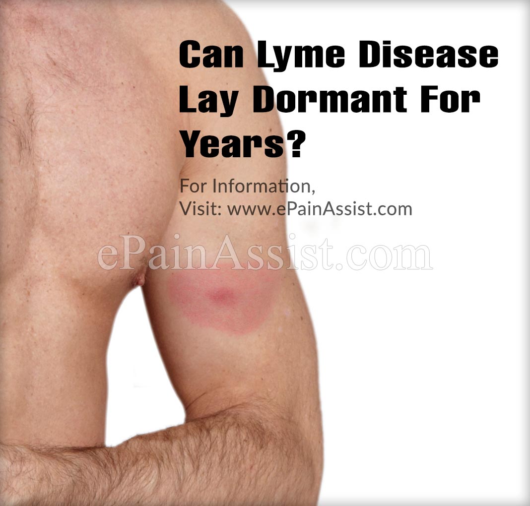 Can Lyme Disease Lay Dormant For Years?
