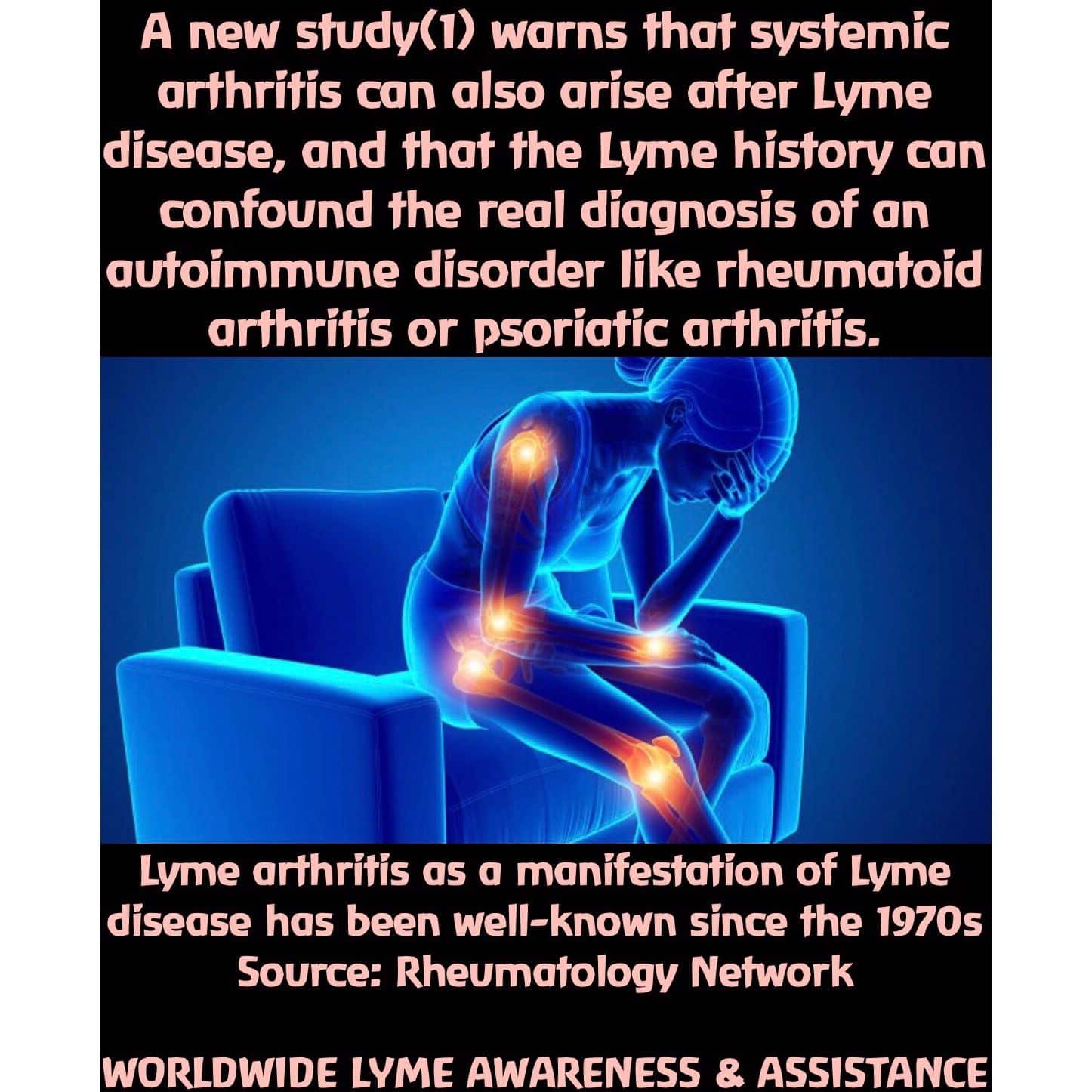 Lyme arthritis