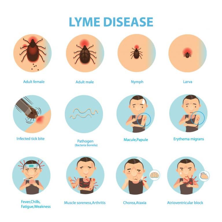 Lyme Disease Treatment: