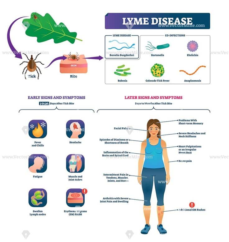 Lyme disease vector illustration â VectorMine