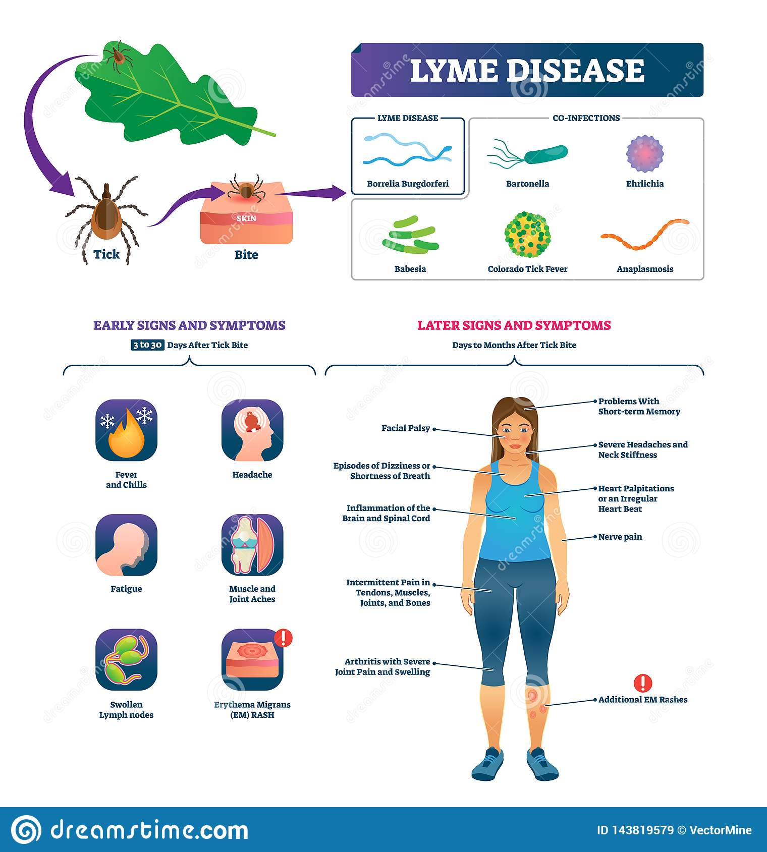 Lyme Disease Vector Illustration. Labeled Tick Bite Infection Symptoms ...