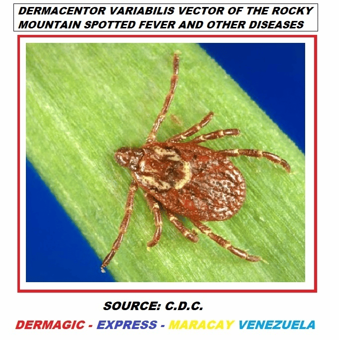 Rocky Mountain Spotted Fever (RMSF)